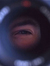 Nick