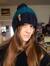 Kayleigh Patchett