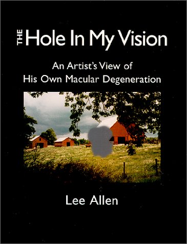 Descarga de pdf de libro real The Hole in My Vision: Watching My Own Age-Related Macular Degeneration
