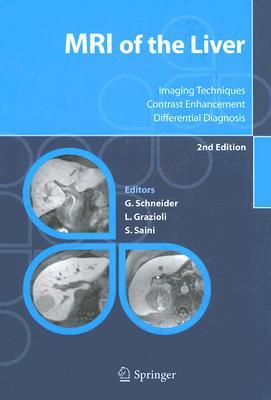 mri-of-the-liver-imaging-techniques-contrast-enhancement-differential-diagnosis