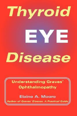 Descargar libros en Internet gratis Thyroid Eye Disease: Understanding Graves' Ophthalmopathy