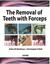 Removal of Teeth with Forceps by Robin W. Matthews