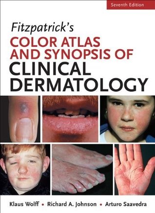 Color atlas synopsis of clinical dermatology