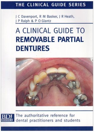 removable partial denture design