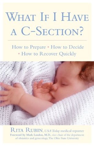 Descarga gratuita de libros electrónicos completos en pdf What If I Have a C-Section?
