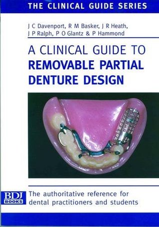 removable partial denture design