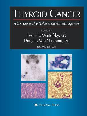 thyroid-cancer-a-comprehensive-guide-to-clinical-management