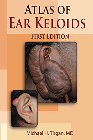 atlas-of-ear-keloids