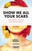 Show Me All Your Scars True Stories of Living with Mental Illness by Lee Gutkind