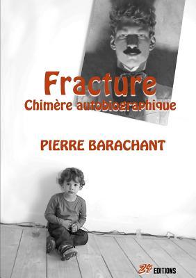 fracture