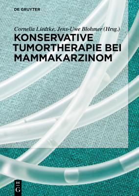 Konservative Tumortherapie Bei Mammakarzinom