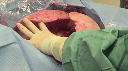 love on life support