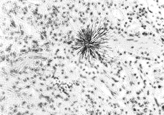 Black Star shows tracks of Alpha particles in an Apes lung much like yours