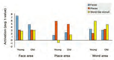 Distinctiveness of the Neural Activation Patterns of Areas of the Brain