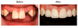 Before/After
Jim Sarji
Dentist in Park Slope
<a href="https://www.dentistparkslope.com">Dentist in Park Slope</a> 