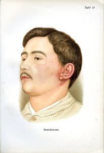 Erdem Tasdelen