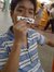 Edmark