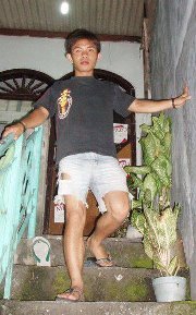 Aldo