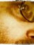 Abnose