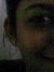 Hemal