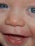 A Bret