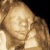 Jason Mesner