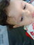Attia A...