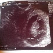 Абель Монтес