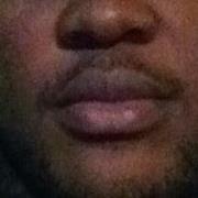 فردیناند لیم