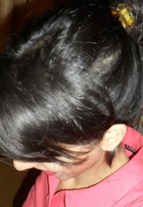 Laleh