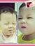 Nguyễn ...