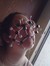 Annette