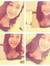 Linelba...
