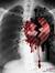 Adel Amer