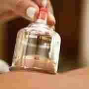 Cupping Hijama