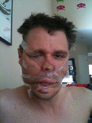 Travis Hilton