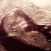 Jade Ferguson-trisolini