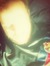 Nick
