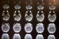 Болд Эрдэнэ