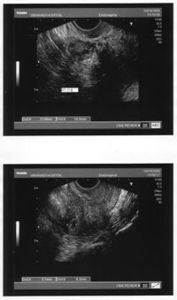 หลักทรัพย์ หัวกลมกลม