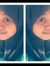 Arlin V...