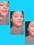 Haley R...