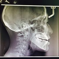 Suthicha Chussananalin