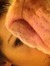 Lynette