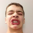Aaron