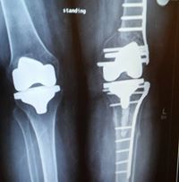 bunni nealer-hasenfus