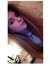 Alice H...