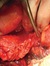 Duodenum