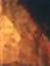 Clotild...