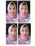 Alda Me...